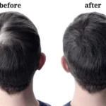 menshair-after-using-cosmetic-powder-600nw-1091518277